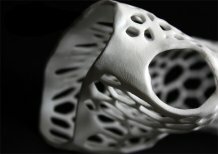 3D-принтер вернул 71-летней женщине возможность ходить