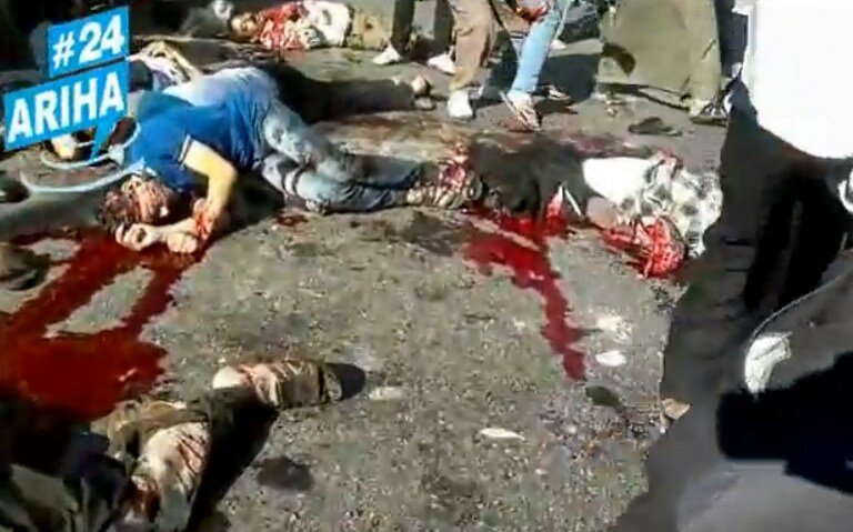 Реалии сирийской войны | Фото: AFP