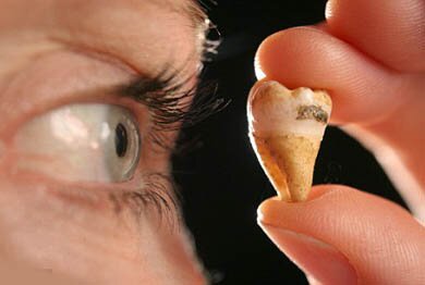 Джона Леннона клонируют из зуба | Фото: Thinkstock