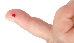 Совершен новый прорыв в создании стволовых клеток | Фото: Thinkstock