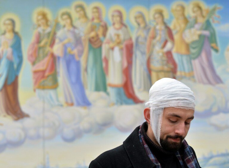 Как украинский Беркут людей калечил | Фото: AFP